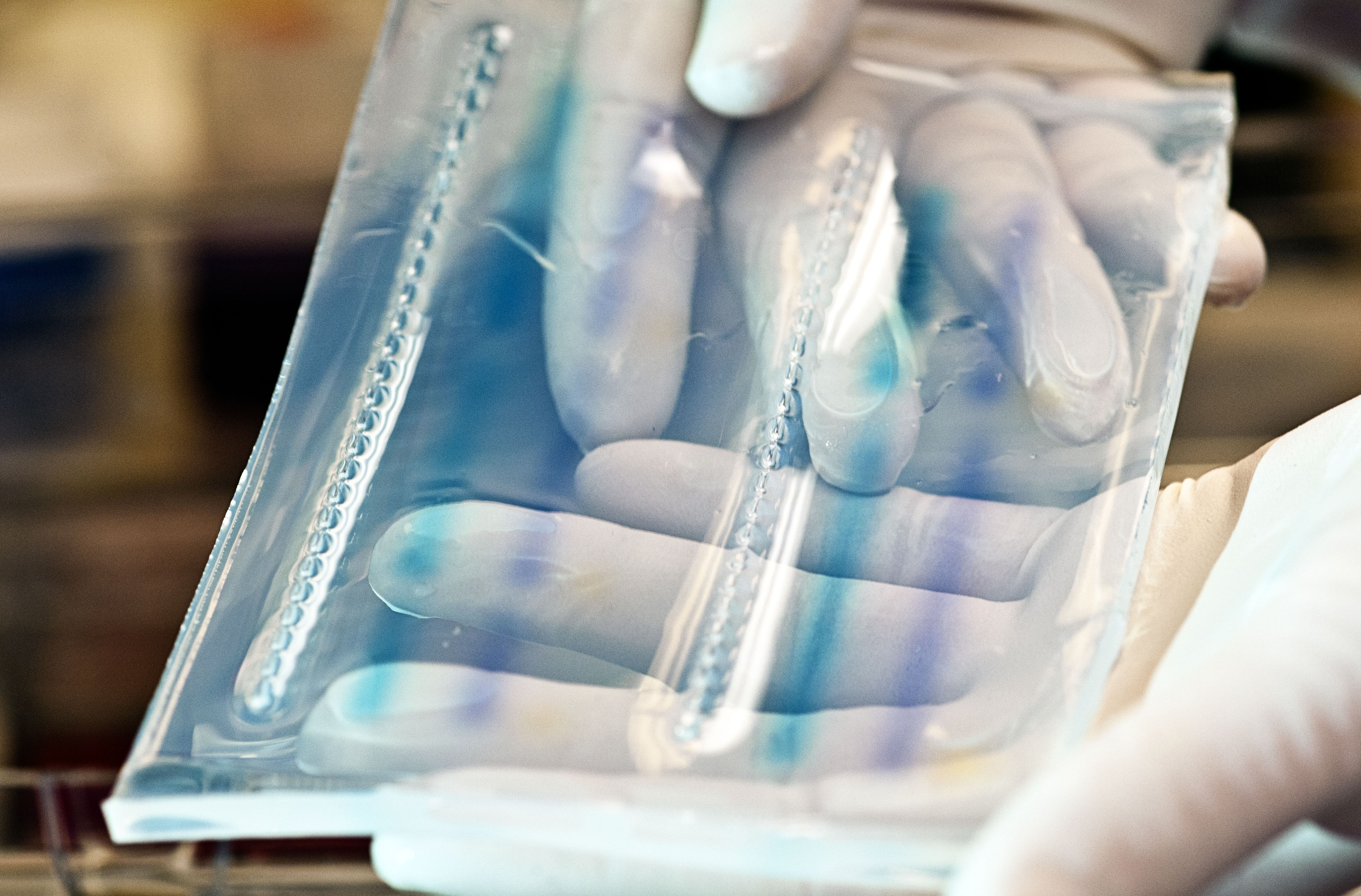 Challenges and Advances in Determining MRD in Solid Tumors