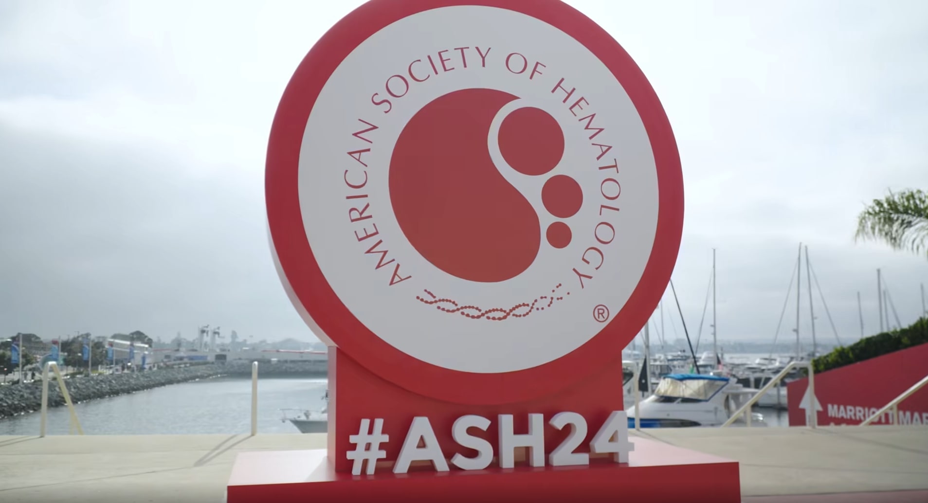 LymphoVista HL assay at the ASH 2024, MRD in Hodgkin Lymphoma